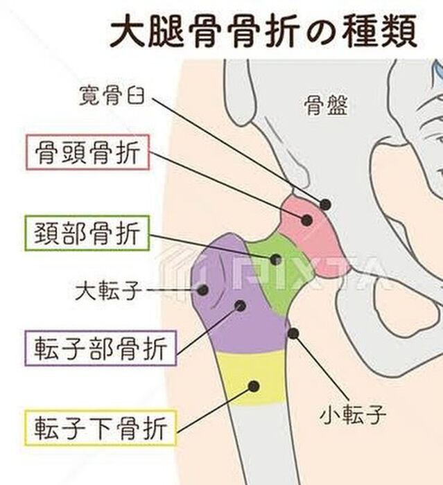 画像2988