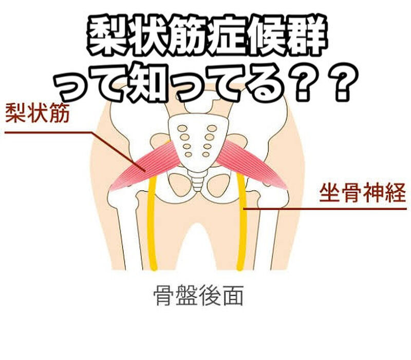 画像3075