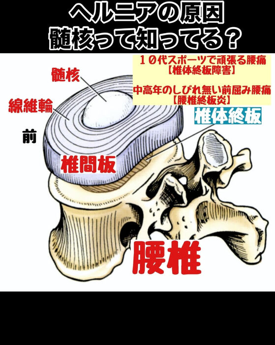 画像3089