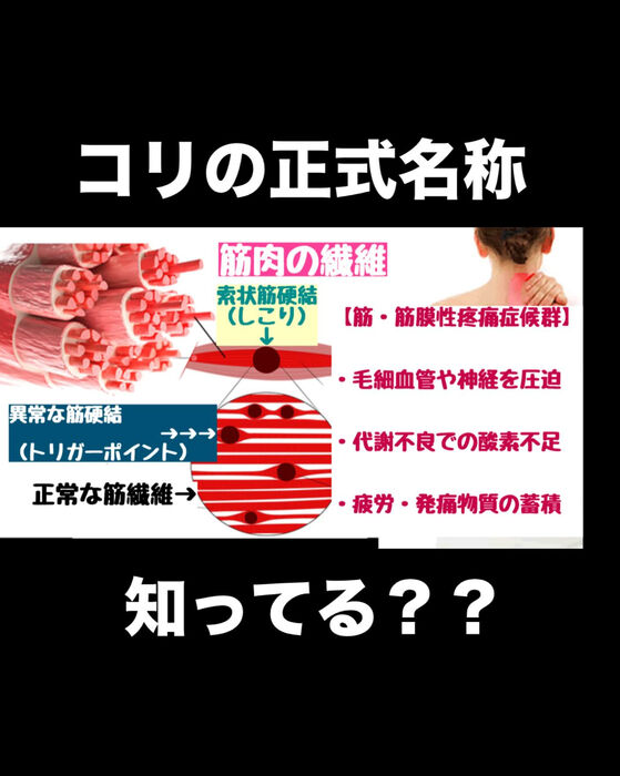 画像3139