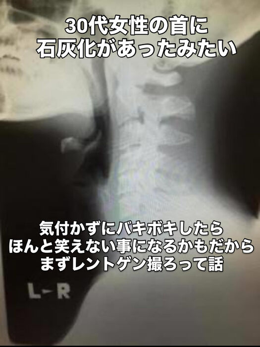 画像3316