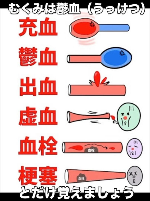 画像3372