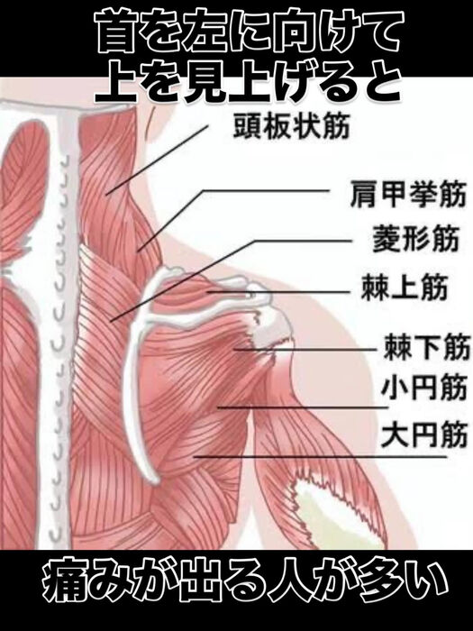 画像3451
